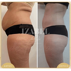 Resultados Kit Fire - Transformação corporal emagrecimento Europa
